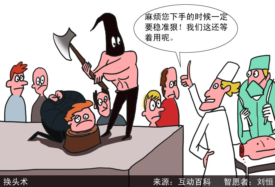 头部移植