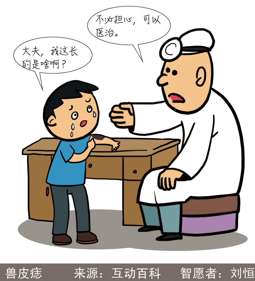 兽皮痣